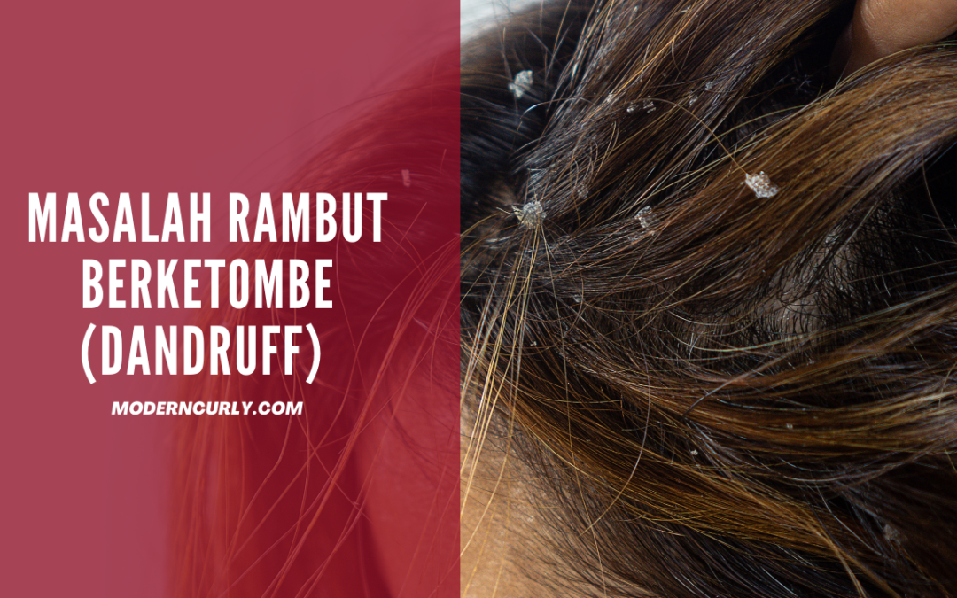 Masalah Rambut Berketombe: Ciri-Ciri, Penyebab dan Cara Mengatasinya!